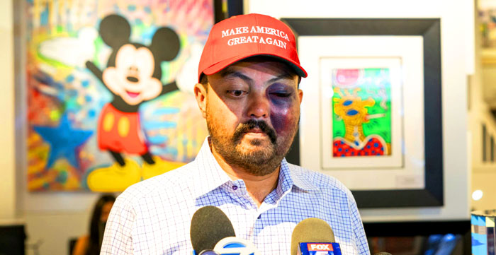 "Jahangir 'John' Turan speaks with reporters Thursday after he says he was beaten by about 15 teenagers for wearing a "Make America Great Again" hat on a New York City street. (Photo: LightRocket/Getty Images.)" - Daily Signal